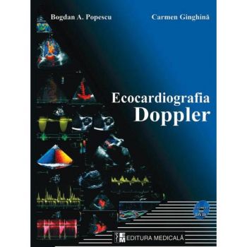 Ecocardiografia Doppler